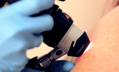 Diagnostikas metodes plantāra kārpai